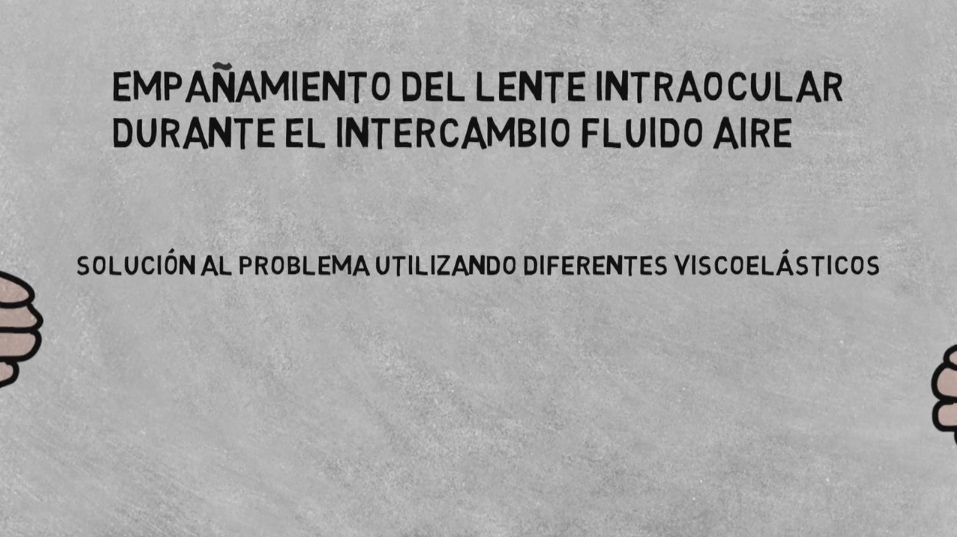 Empañamiento del lente intraocular durante el intercambio fluido – Solución al problema utilizando diferentes viscoelasticos